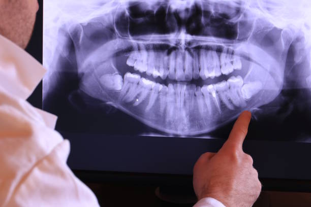 Best Emergency Dental Care for Abscessed Tooth in Fairfax, IA